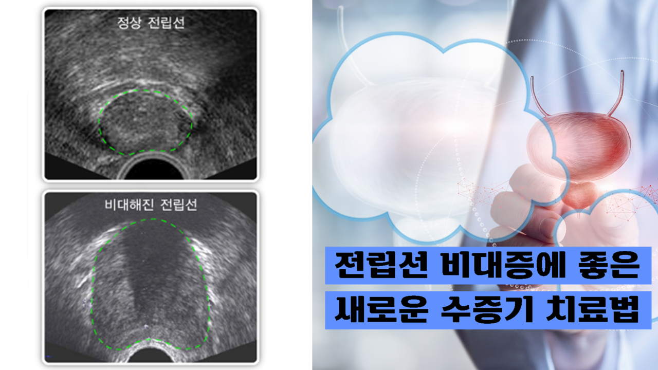 출처:질병관리청