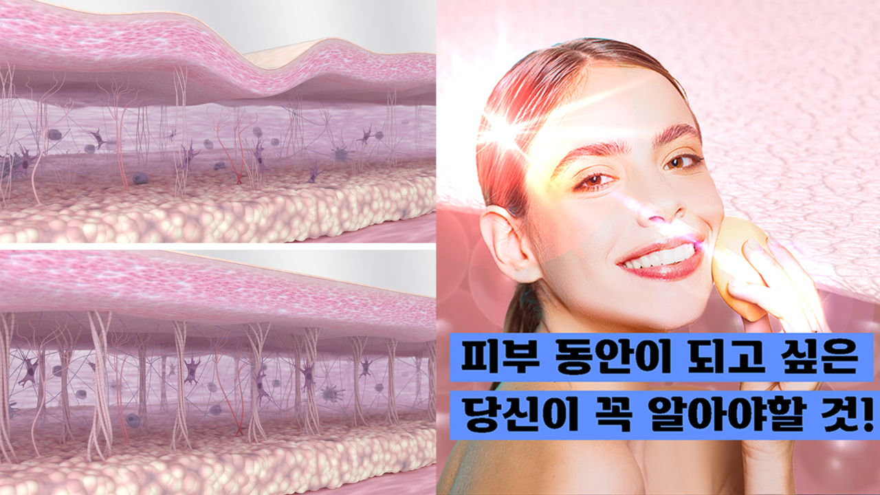 모션엘리먼츠 - 노화된 피부와 젊은 피부의 차이를 나타낸 그림