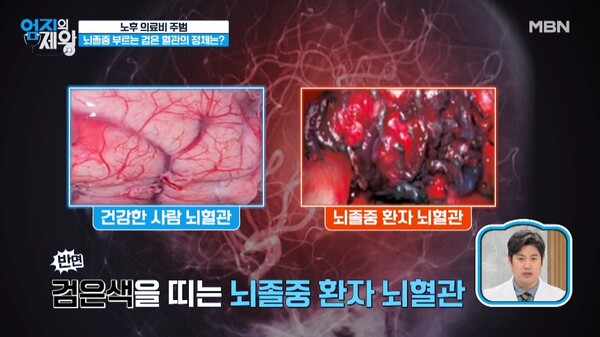 출처 : MBN '엄지의 제왕' 캡처