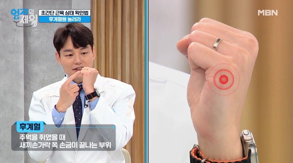 출처 : MBN '엄지의 제왕' 캡처