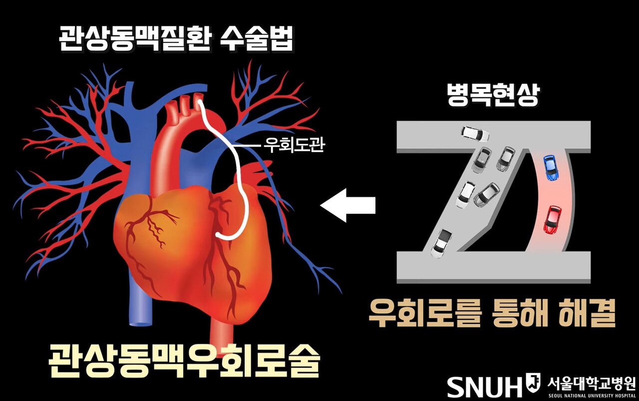 빠르게 도착하면 방법은 얼마든지 있다 / 출처 : 서울대학교병원