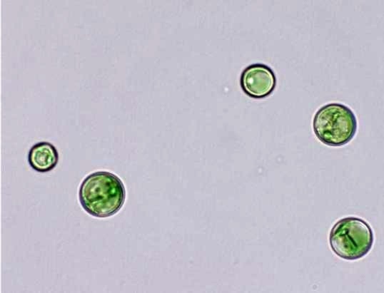 클로렐라 글로리오사 MABIK LP119 광학현미경 사진 / 출처 : 국립해양생물자원관