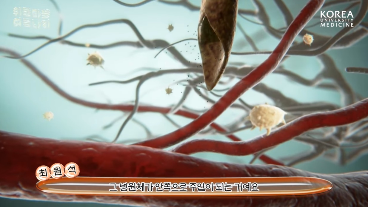 말라리아는 모기가 원충을 '옮기는' 방식으로 감염된다 / 출처 : 고대병원 유튜브 채널