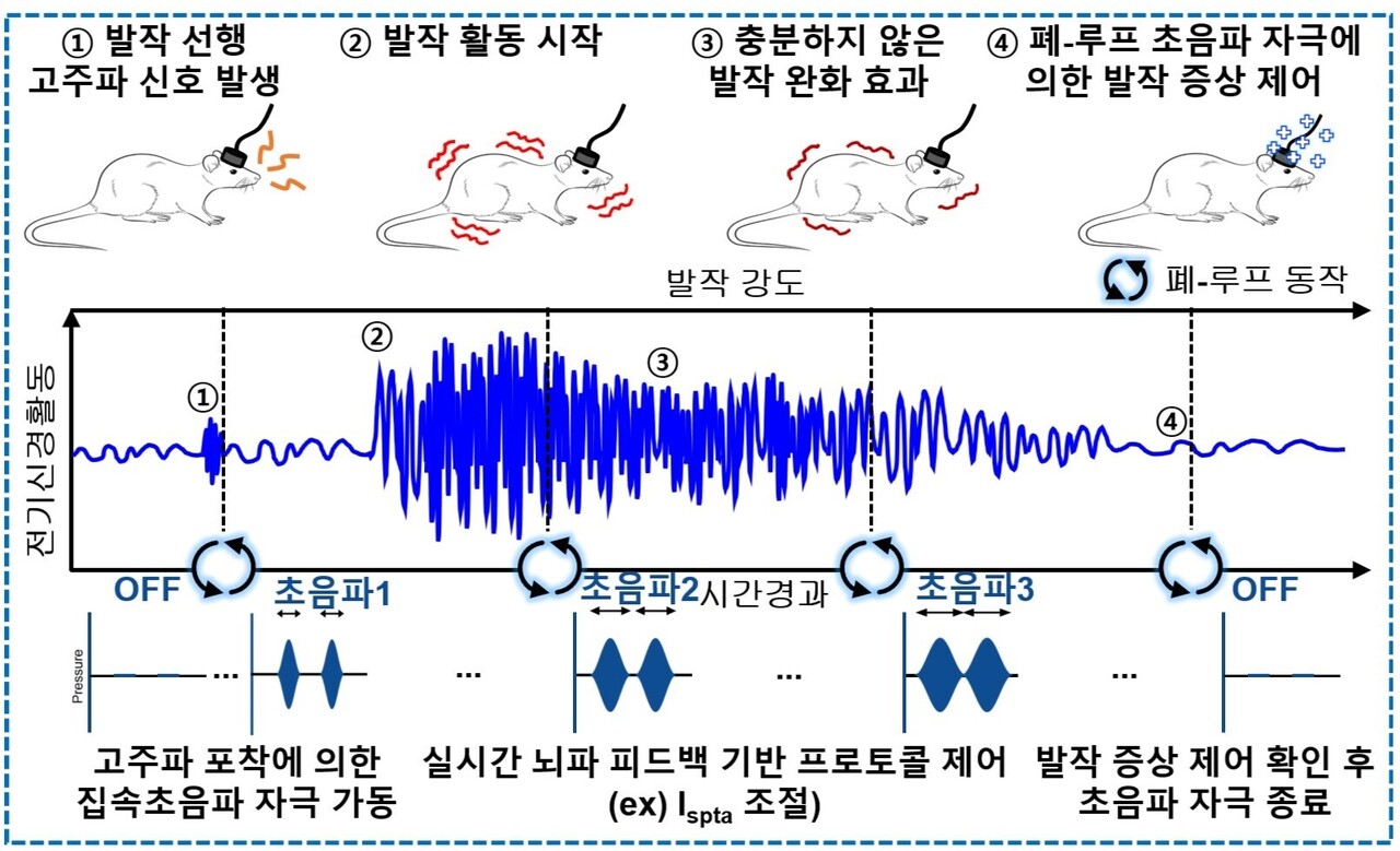 전자약 시스템은 형상변형 대뇌피질접착 신축성 전자패치와 소형 경두개 집속초음파 변환기로 구성된다. 먼저, 쥐의 머리에 전자패치를 부착하고 소형 경두개 집속초음파 변환기를 이식해, 무손실 대뇌피질전도 피드백 폐-루프 발작 제어가 가능하도록 전자약 시스템을 구성했다. 그리고 뇌전증을 유발한 쥐를 대상으로 16채널 전자패치를 이용해 대뇌피질전도를 실시간으로 모니터링했다. 고품질 뇌파 측정은 집속초음파 전자약의 3단계 강도 변조 중에도 안정적으로 가능했으며, 폐-루프 뇌전증 제어를 성공적으로 달성했다. / 출처 : 기초과학연구원