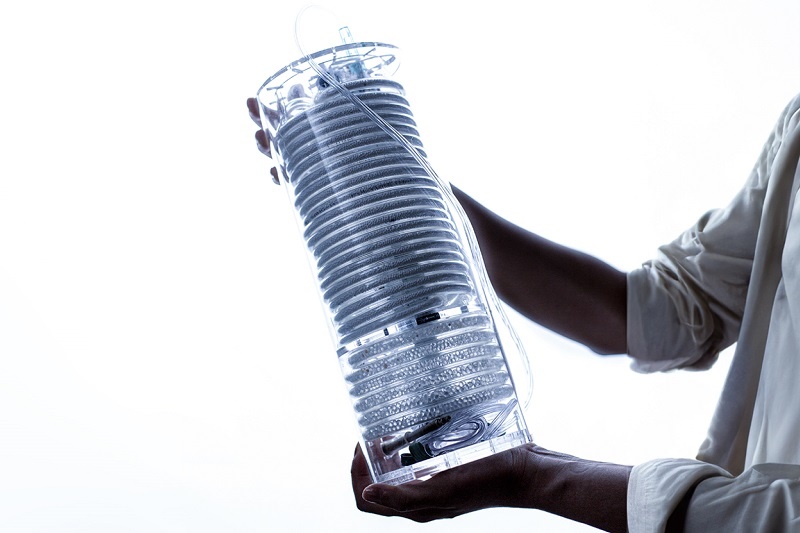 옥시나이저 실제 모습 / 출처 : 카이스트 연구뉴스