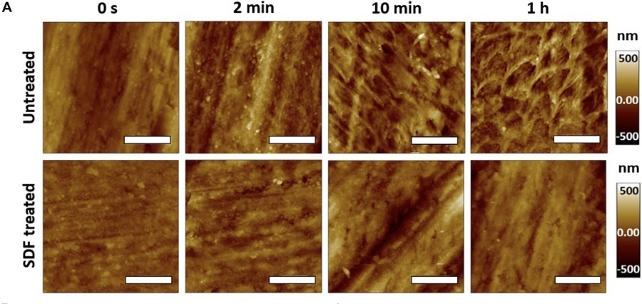 SDF 표면 처리가 되지 않은 치아(위)는 SDF 처리가 된 치아(아래)에 비해 확연하게 표면이 거칠어진 모습을 보였다 / 출처 : 카이스트 연구뉴스