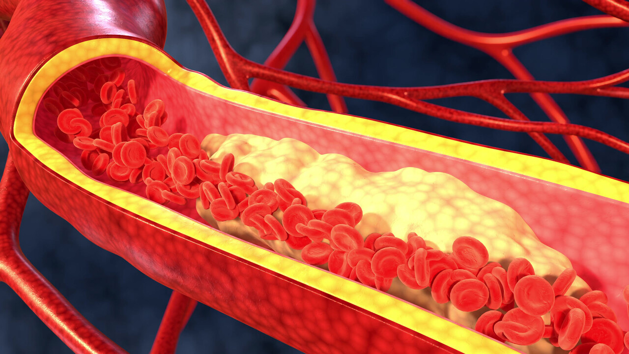 HDL은 혈관 속 콜레스테롤을 청소하는 역할을 한다 / 이미지 출처 : Motion Elements