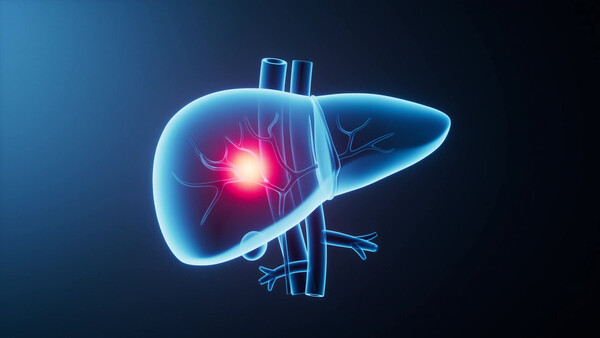 이미지 출처 : Motion Elements