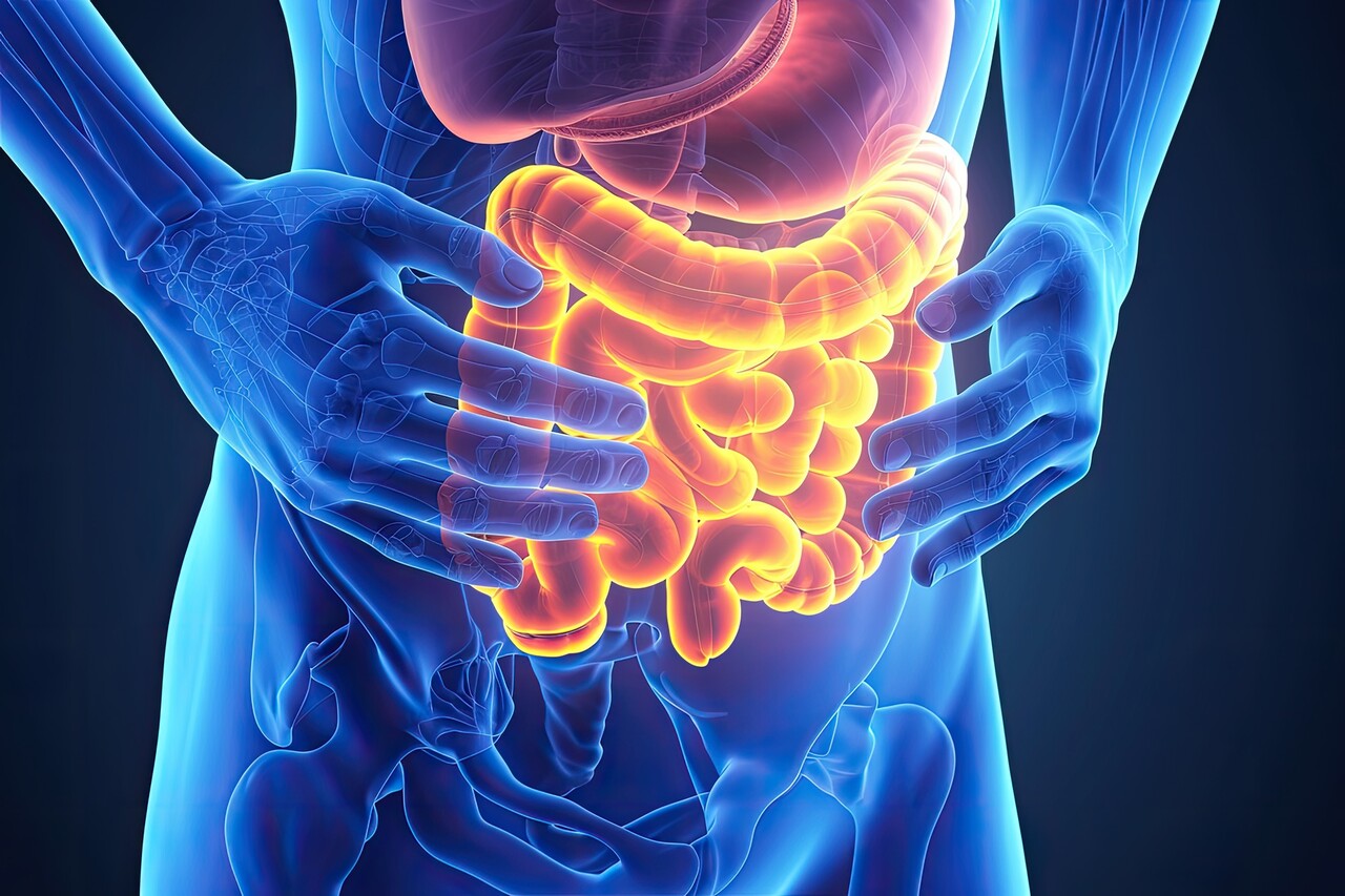 이미지 출처 : Motion Elements