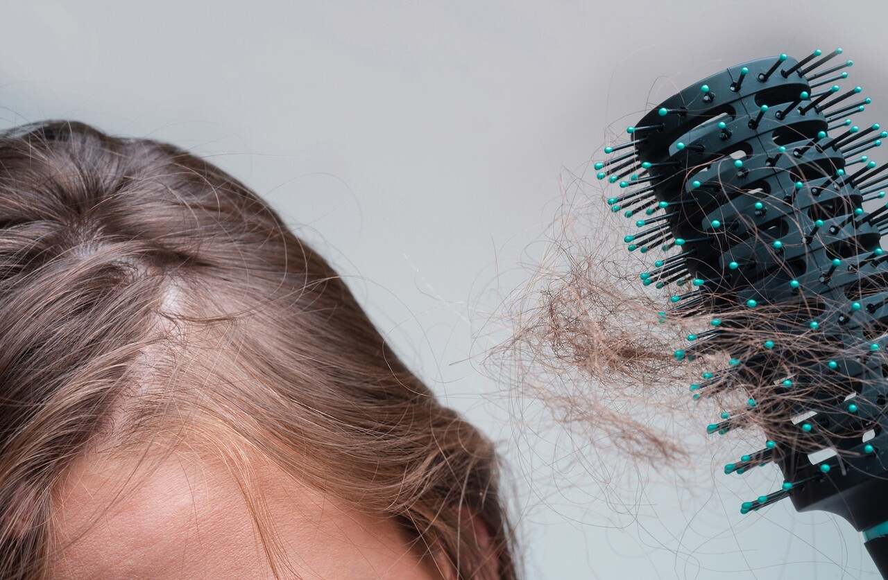 이미지 출처 : Motion Elements