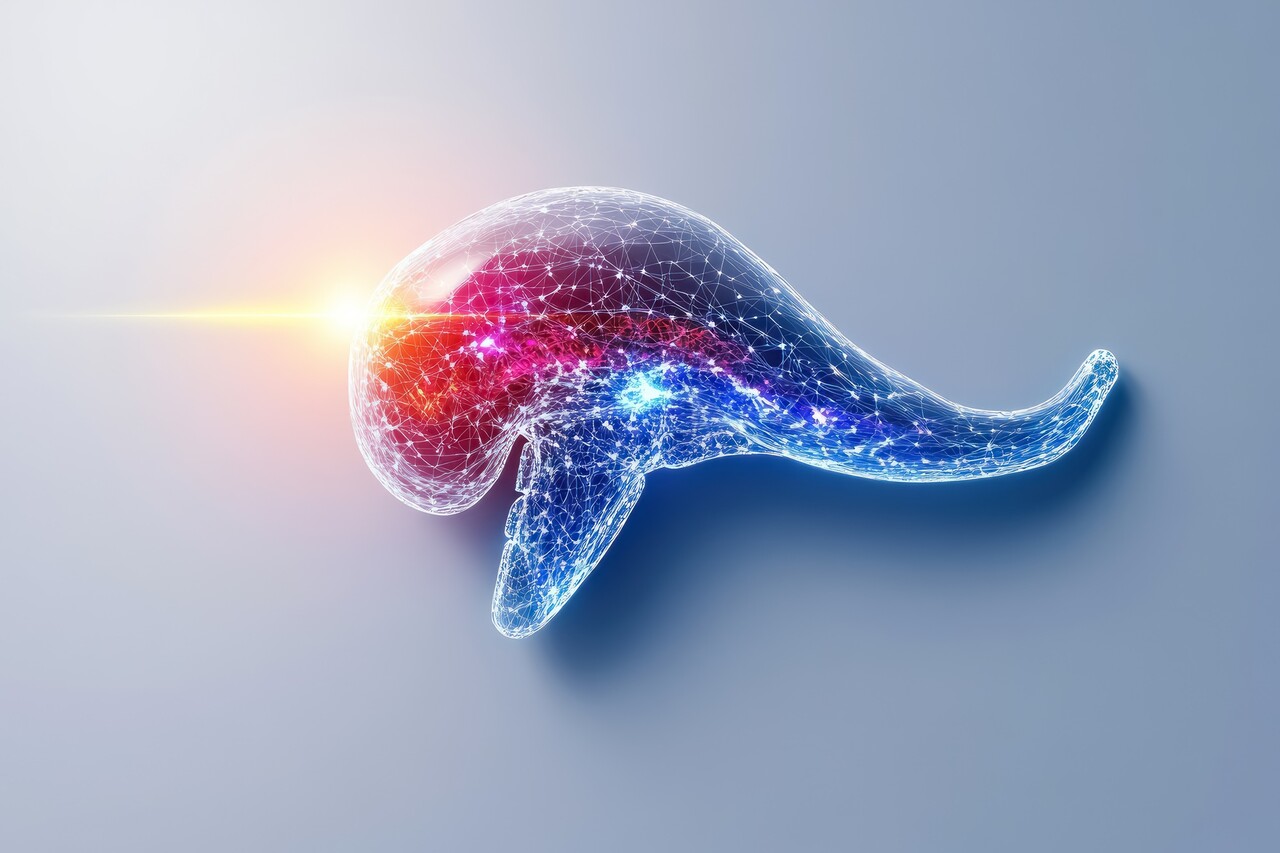 이미지 출처 : Motion Elements