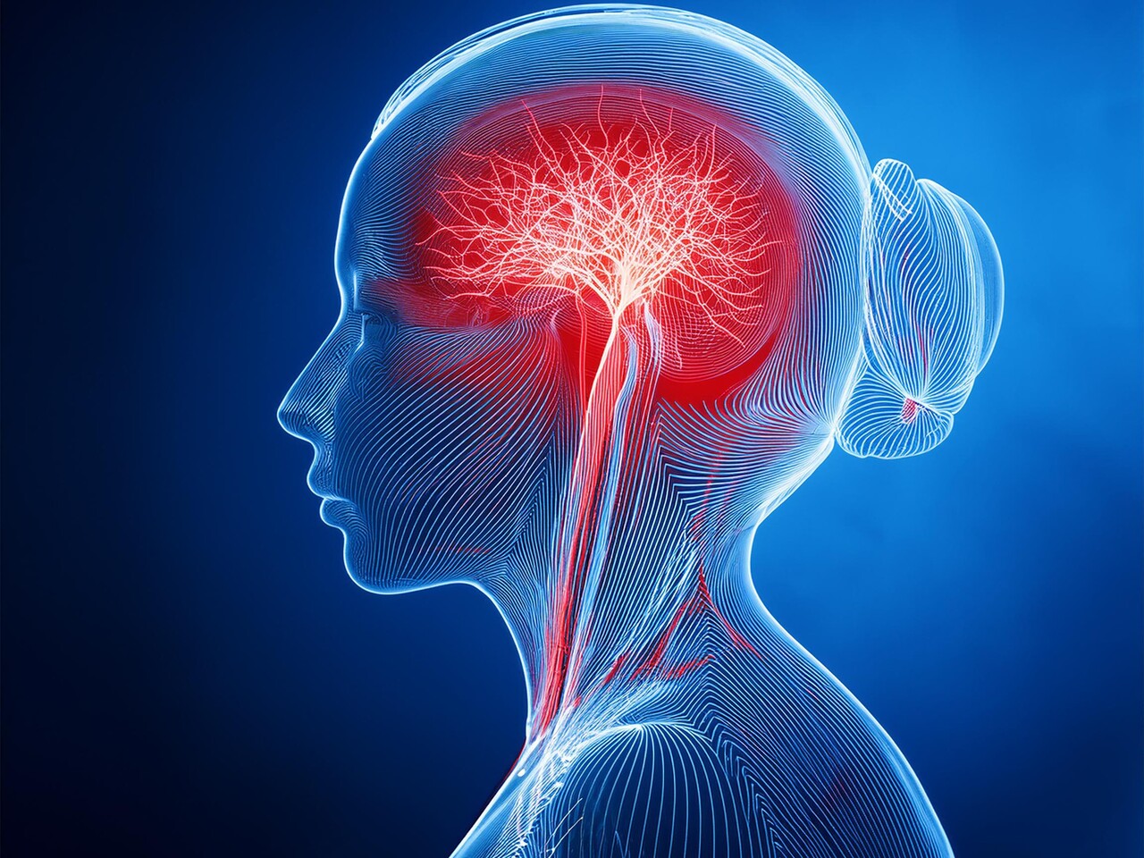 이미지 출처 : Motion Elements