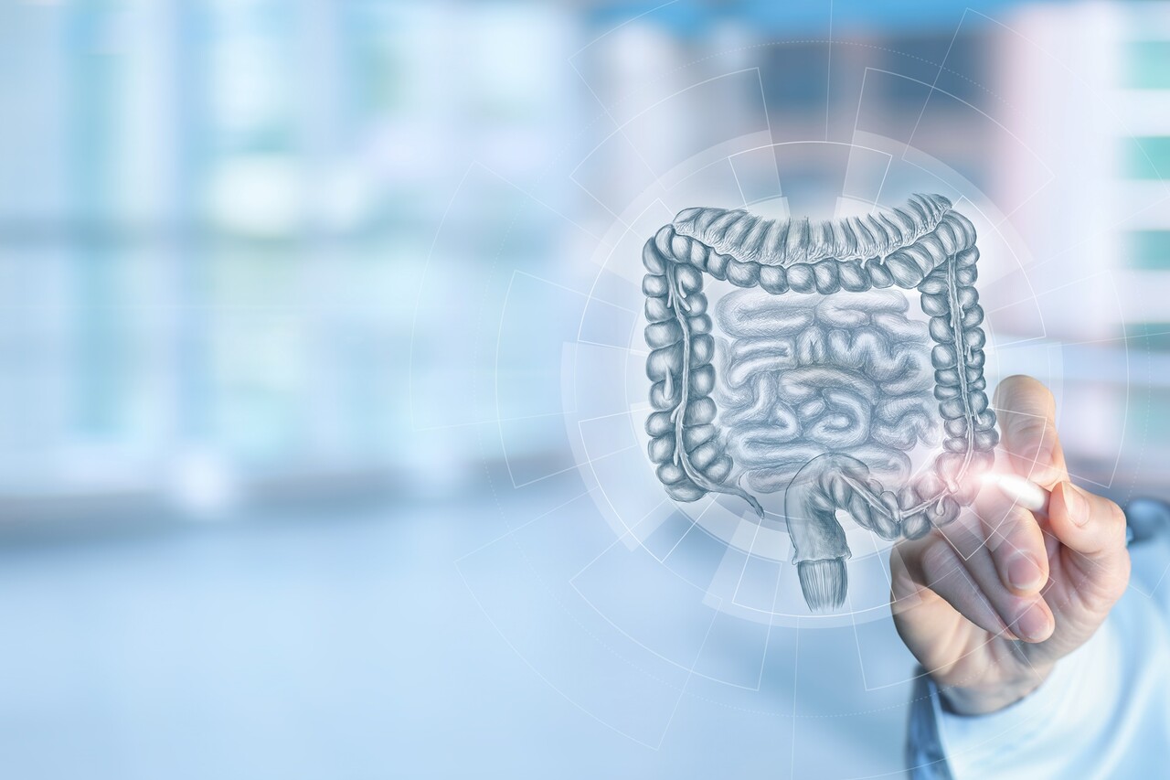 이미지 출처 : Motion Elements