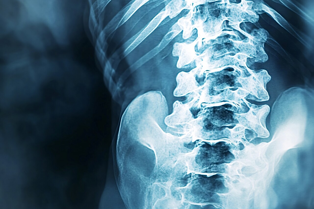 이미지 출처 : Motion Elements