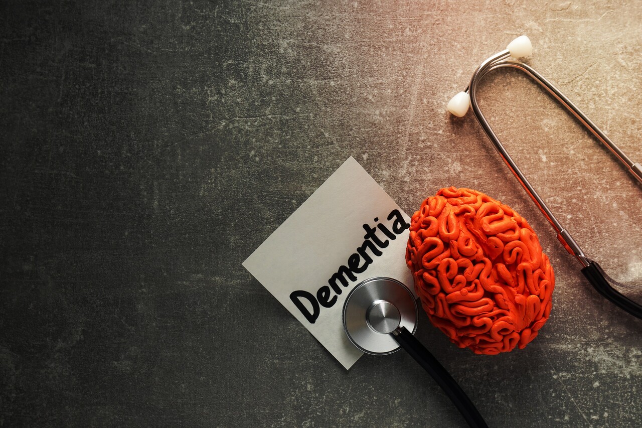 보다 강력한 신경 보호 효과를 제공할 수 있는 약물에 대한 연구가 진행 중이다 / 이미지 출처 : Motion Elements