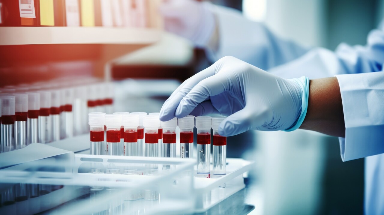 이미지 출처 : Motion Elements