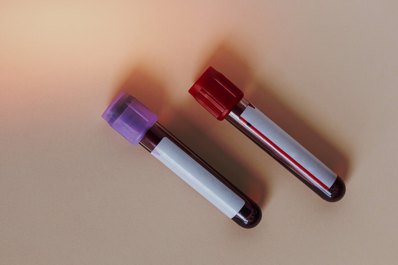 소량의 혈액으로 다양한 검사를 하기 위해서는 높은 민감도와 낮은 오류율이 필수다 / 이미지 출처 : Motion Elements