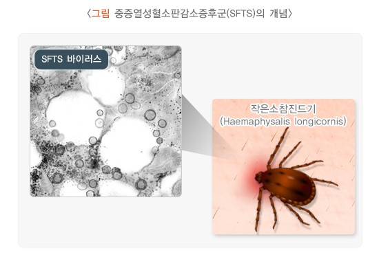출처 : 국가건강정보포털