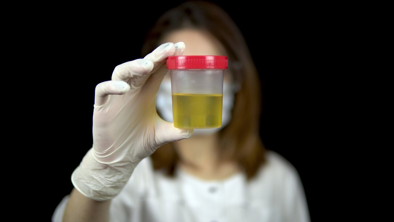 이미지 출처 : Motion Elements