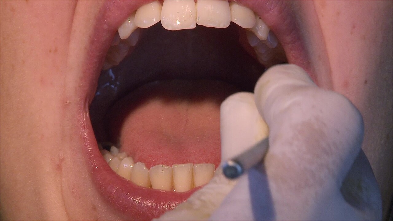 구강암은 입속 어디서든 발생할 수 있으며, 초기에 발견해야 완치율이 높다 / 이미지 출처 : Motion Elements