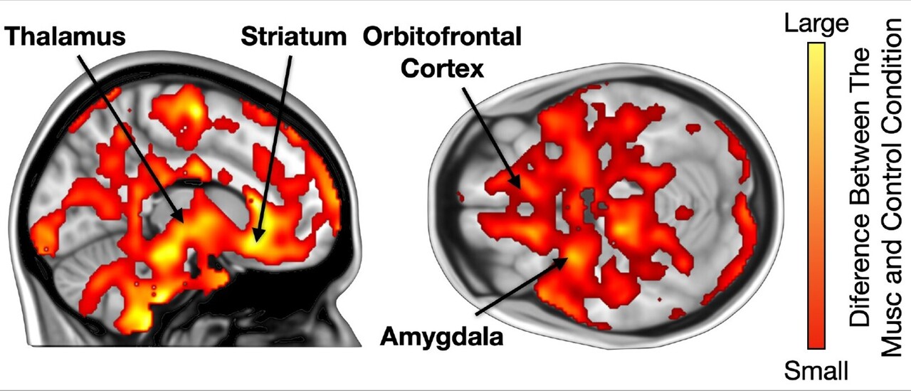 좋아하는 음악이 오피오이드 분비에 영향을 미치는 뇌 영역 / 출처 : 투르쿠 PET 센터