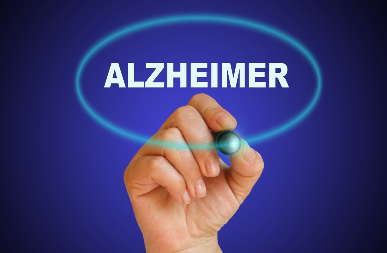 이미지 출처 : Motion Elements