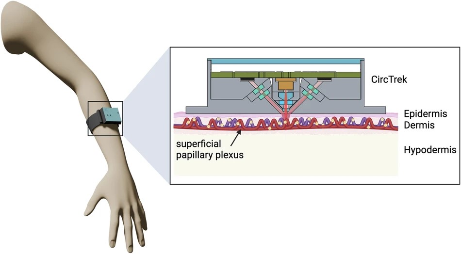 CircTrek의 원리 / 출처 : NPJ Nature Biosensing