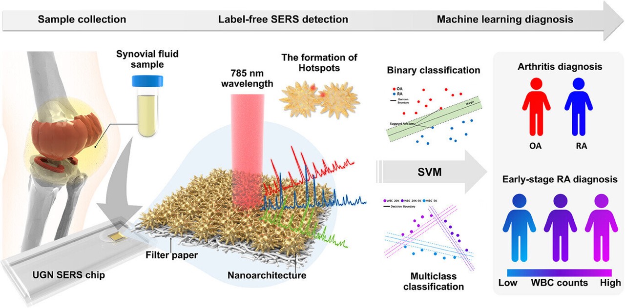 관절 활액으로 관절염을 신속하게 진단할 수 있는 기술 모식도 / 출처 : 한국재료연구소(KIMS)
