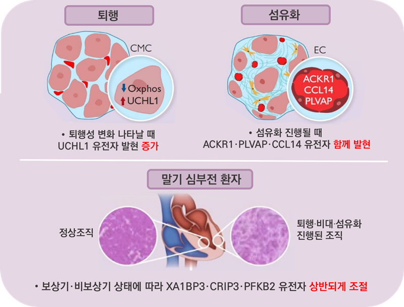 희귀·난치성 심근병증, 발병 단계·조직 손상 따라 달라지는 유전자 규명 / 출처 : 서울아산병원