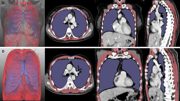 제공: 서울대병원