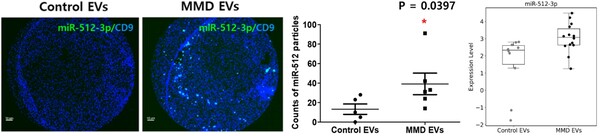 [그림1] 모야모야병 환자(MMD)와 정상 대조군(Control)의 혈장에서 분리한 세포외소포 내 miRNA를 분석한 결과. 환자군에서 miR-512-3p의 발현(Expression Level)이 유의미하게 높은 것으로 나타났다.