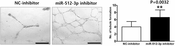 [그림2] miR-512-3p 억제제 처리 후 모야모야병 환자 세포에서 혈관 형성 능력이 유의미하게 향상됨.
